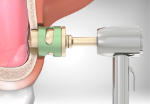 Sinus solutions